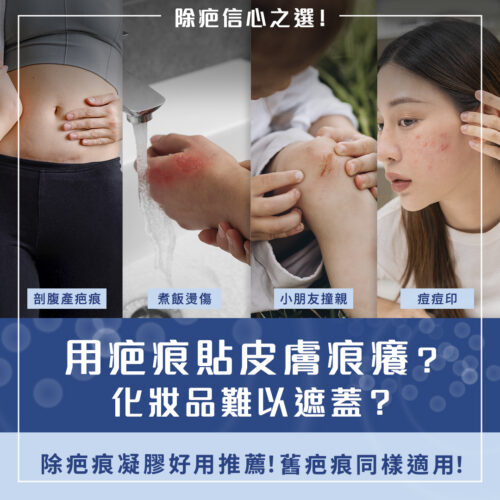 除疤產品好用推薦2025｜管理剖腹產疤痕/燙傷疤痕/兒童疤痕/暗瘡疤痕全攻略